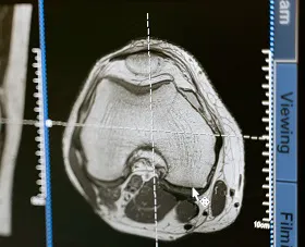 Tumori: da SIRM e AIOM le raccomandazioni per la tomografia computerizzata